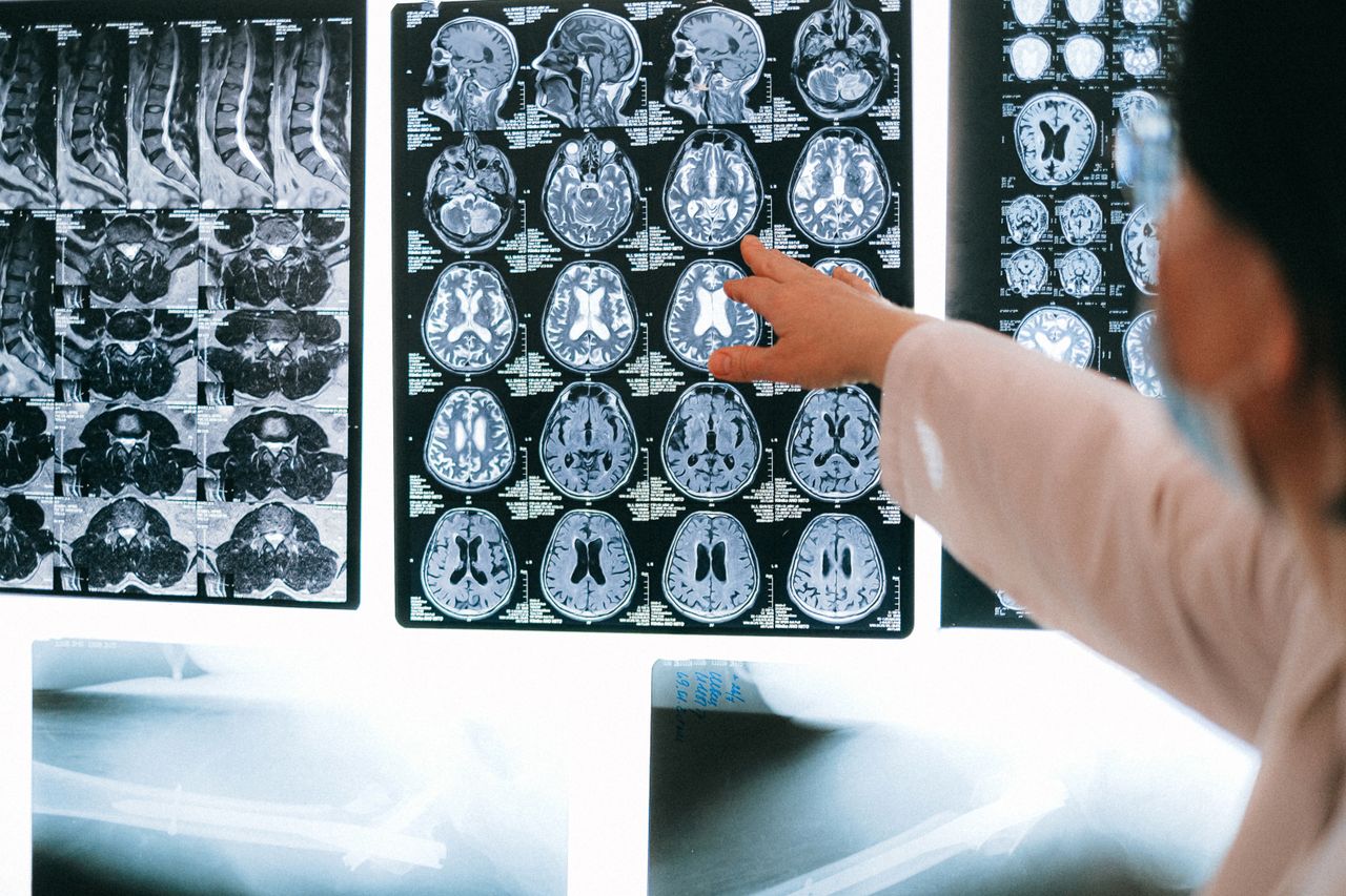 Crafting Captivating Headlines: Your awesome post title goes here Radiologist pointing at brain MRI scans showing detailed medical examination.